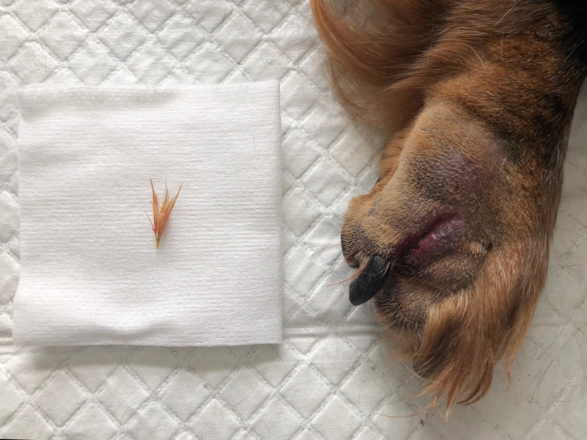 Osina vytažena z meziprstí